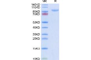Human APLP2 on Tris-Bis PAGE under reduced condition. (APLP2 Protein (AA 32-692) (His tag))
