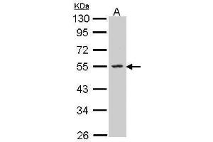 WB Image Sample (30 ug of whole cell lysate) A: Molt-4 , 10% SDS PAGE antibody diluted at 1:500 (SPHK1 antibody  (C-Term))