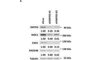 SMYD3 knockdown downregulates HR gene expressions. (MDC1 antibody)