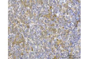 IHC analysis of RRS1 using anti-RRS1 antibody (ABIN7602918). (RRS1 antibody  (C-Term))