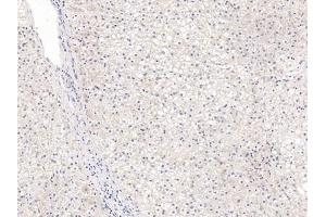 Detection of GPC3 in Human Liver Tissue using Polyclonal Antibody to Glypican 3 (GPC3) (Glypican 3 antibody  (AA 343-559))