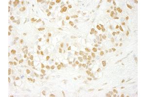 anti-CDC5 Cell Division Cycle 5-Like (S. Pombe) (CDC5L) (AA 752-802) antibody