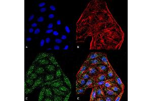 Immunocytochemistry/Immunofluorescence analysis using Mouse Anti-CD74 Monoclonal Antibody, Clone 6D9 . (CD74 antibody  (AA 1-100))