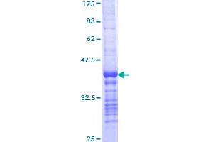 LIG1 Protein (AA 810-919) (GST tag)