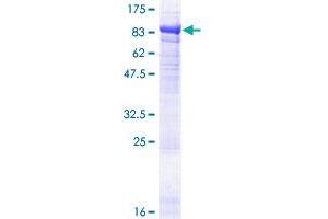 EPM2AIP1 Protein (AA 1-607) (GST tag)