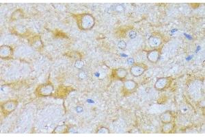 Immunohistochemistry of paraffin-embedded Rat brain using ACADSB Polyclonal Antibody at dilution of 1:100 (40x lens).