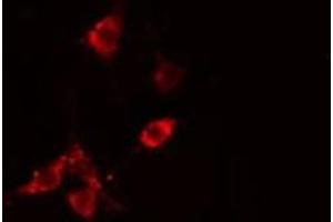 ABIN6275502 staining  HepG2 cells by IF/ICC. (RHOB antibody  (Internal Region))