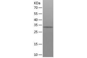 Western Blotting (WB) image for Olfactory Receptor, Family 1, Subfamily A, Member 1 (OR1A1) (AA 1-309) protein (His tag) (ABIN7289174) (OR1A1 Protein (AA 1-309) (His tag))