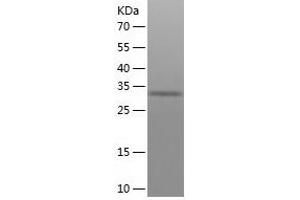 OR1A1 Protein (AA 1-309) (His tag)