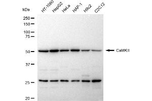 Western blotting analysis using CaMKII antibody (ABIN7797836).