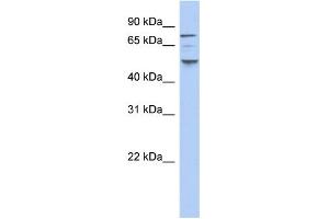 WB Suggested Anti-CSNK1E Antibody Titration: 0. (CK1 epsilon antibody  (N-Term))