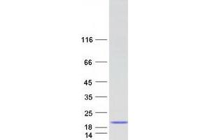 Validation with Western Blot (MYL6 Protein (Transcript Variant 2) (Myc-DYKDDDDK Tag))