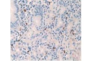 Detection of 0 in Human Stomach Tissue using Monoclonal Antibody to Amylin (Amylin/DAP antibody)