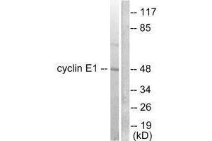 Western blot analysis of extracts from K562 cells, using Cyclin E1 antibody. (Cyclin E1 antibody)