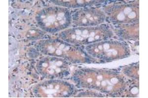 IHC-P analysis of Rat Intestine Tissue, with DAB staining. (IL12A antibody  (AA 23-215))