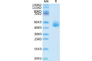 Human DLK1 on Tris-Bis PAGE under reduced condition. (DLK1 Protein (AA 24-303) (His tag))