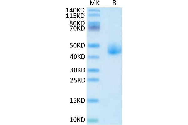 DLK1 Protein (AA 24-303) (His tag)