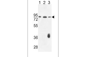 F12 Antibody (N-term) (ABIN653621 and ABIN2842977) western blot analysis in K562(lane 1),CEM(lane 2),MDA-M(lane 3) cell line lysates (35 μg/lane).