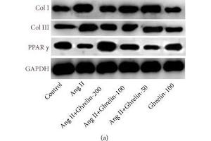 The effect of different concentrations of Ghrelin on collagen I, collagen III, and PPAR-γ protein expression in Ang II-infused rats. (GAPDH antibody  (AA 1-335))