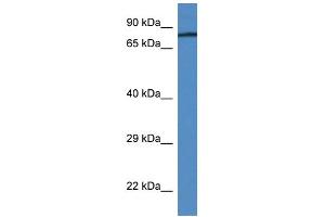 WB Suggested Anti-F2 Antibody   Titration: 1.