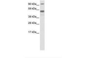 Image no. 2 for anti-Septin 4 (SEPT4) (N-Term) antibody (ABIN6735940) (Septin 4 antibody  (N-Term))