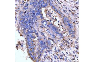 IHC analysis of Giantin/GOLGB1 using anti-Giantin/GOLGB1 antibody (ABIN7600139). (Golgin B1 (GOLGB1) (AA 153-950) antibody)