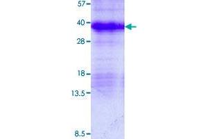 Image no. 1 for Microfibrillar Associated Protein 2 (MFAP2) (AA 18-183) protein (His tag) (ABIN5569820) (MFAP2 Protein (AA 18-183) (His tag))