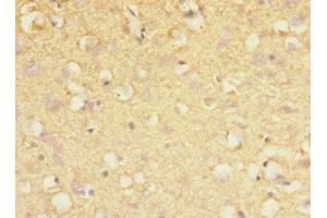 Immunohistochemistry of paraffin-embedded human brain tissue using ABIN7169067 at dilution of 1:100 (MARK1 antibody  (AA 560-700))