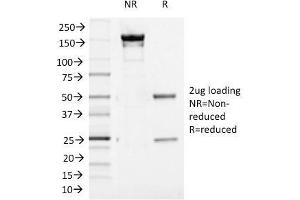SDS-PAGE Analysis Purified Aurora B Mouse Monoclonal Antibody (AURKB/1521). (Aurora Kinase B antibody  (AA 89-251))