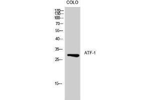 Western Blotting (WB) image for anti-Activating Transcription Factor 1 (AFT1) (Ser157) antibody (ABIN3183409) (AFT1 antibody  (Ser157))