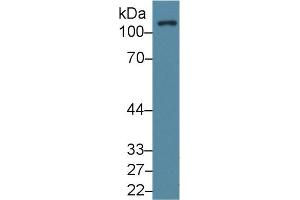 Western Blot; Sample: Human Lung lysate; Primary Ab: 1µg/ml Rabbit Anti-Human FAK Antibody Second Ab: 0. (FAK antibody  (AA 798-1041))