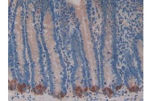 DAB staining on IHC-P; Samples: Rat Intestine Tissue (BRCA2 antibody  (AA 2913-3151))