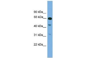 WB Suggested Anti-Npas1 Antibody Titration: 0. (NPAS1 antibody  (Middle Region))