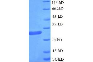 SDS-PAGE (SDS) image for Suppressor of Cytokine Signaling 1 (SOCS1) (AA 1-211), (full length) protein (His tag) (ABIN5710396) (SOCS1 Protein (AA 1-211, full length) (His tag))