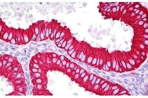 Anti-KRT18 / Cytokeratin 18 antibody IHC staining of human uterus, endometrium. (Cytokeratin 18 antibody  (AA 381-430))
