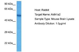Host: Mouse Target Name: ALDH1A2 Sample Tissue: Mouse Brain Antibody Dilution: 1ug/ml (ALDH1A2 antibody  (C-Term))
