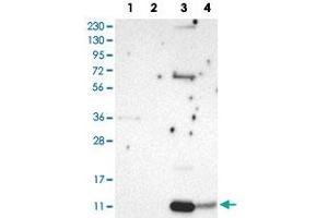 Western Blot analysis of Lane 1: RT-4 cell, Lane 2: U-251 MG sp cell, Lane 3: human plasma tissue (IgG/HSA depleted) and Lane 4: human liver tissue lysates with PPBP polyclonal antibody . (CXCL7 antibody)