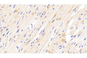 Detection of TIMP4 in Human Cardiac Muscle Tissue using Polyclonal Antibody to Tissue Inhibitors Of Metalloproteinase 4 (TIMP4) (TIMP4 antibody  (AA 32-224))