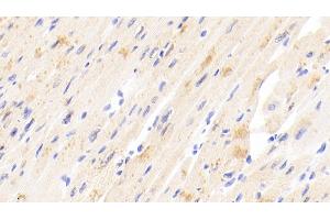 Detection of TIMP4 in Human Cardiac Muscle Tissue using Polyclonal Antibody to Tissue Inhibitors Of Metalloproteinase 4 (TIMP4)
