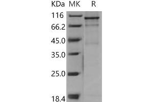 Western Blotting (WB) image for FES Proto-Oncogene, Tyrosine Kinase (FES) (Active) protein (GST tag,His tag) (ABIN7317053)