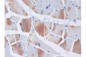Immunohistochemistry (IHC) image for anti-Transcription Elongation Factor B (SIII), Polypeptide 3 (110kDa, Elongin A) (TCEB3) (AA 200-344) antibody (ABIN1858711)