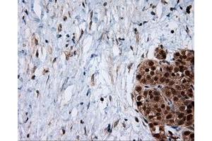 Immunohistochemical staining of paraffin-embedded Kidney tissue using anti-SRR mouse monoclonal antibody.