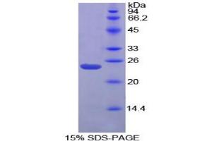 SDS-PAGE analysis of Chicken Gremlin 1 Protein. (GREM1 Protein)