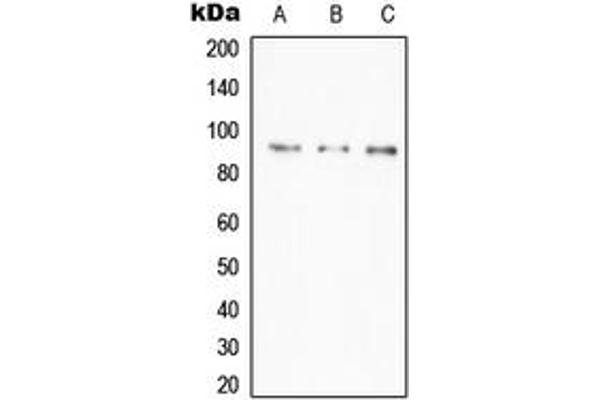 IGKV1-27 antibody  (Center)