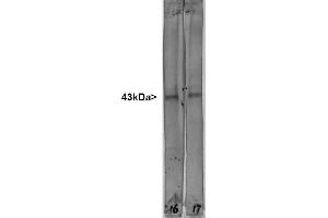 Western blot of whole rat spinal cord lysates probed with ABIN1580421 antibody to GAP43 in lane 16 and another similar antibody in lane 17. (GAP43 antibody)