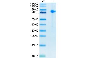Notch1 Protein (His-Avi Tag,Biotin)