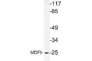 Western blot (WB) analysis of MDFI antibody in extracts from Jurkat cells. (MDFI antibody)