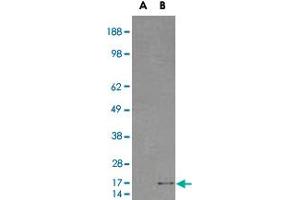 HEK293 overexpressing SH2D1A and probed with SH2D1A polyclonal antibody  (mock transfection in first lane), tested by Origene. (SH2D1A antibody)