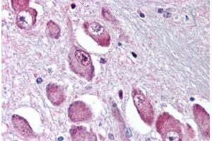 Anti-GABRA3 antibody  ABIN1048639 IHC staining of human brain, basal nucleus of Meynert. (GABRA3 antibody  (N-Term))
