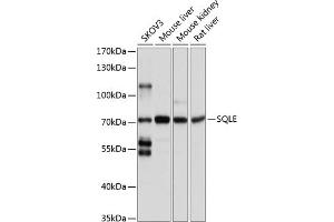 Western blot analysis of extracts of various cell lines, using SQLE antibody (ABIN1513563, ABIN5664074, ABIN5664075, ABIN5664076 and ABIN6219540) at 1:1000 dilution. (SQLE antibody  (AA 143-400))